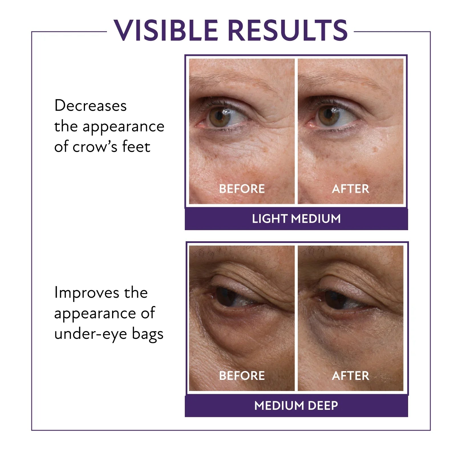 60-Second Eye Effects (Buy 1, Get 1 Free)